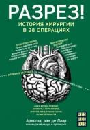 Книга Арнольд ван де Лаар «Разрез! История хирургии в 28 операциях» 978-617-7561-41-4