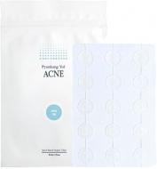 Патчі Pyunkang Yul пластирі від запалень і акне 15 шт.