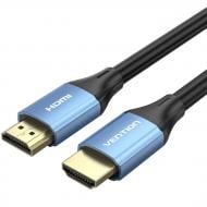 Кабель Vention HDMI M - M V2.0 4K 60 Гц Aluminum alloy 8 м чорний із синім (ALHSK)