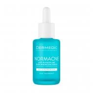 Сыворотка для лица Dermedic Normacne для сужения пор 30 мл