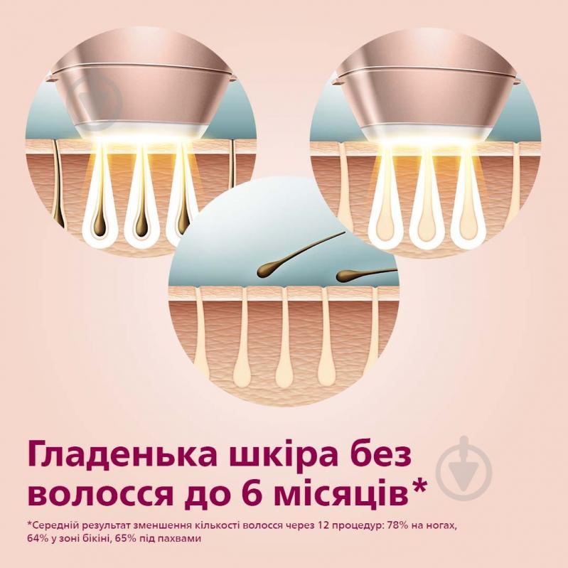 Фотоепілятор Philips Lumea Series 9000 BRI958/00 Lumea IPL 9000 Series BRI958/00 - фото 3