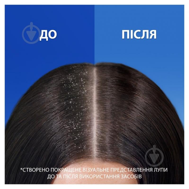 Шампунь Head & Shoulders Зволожуючий догляд 400 мл - фото 4