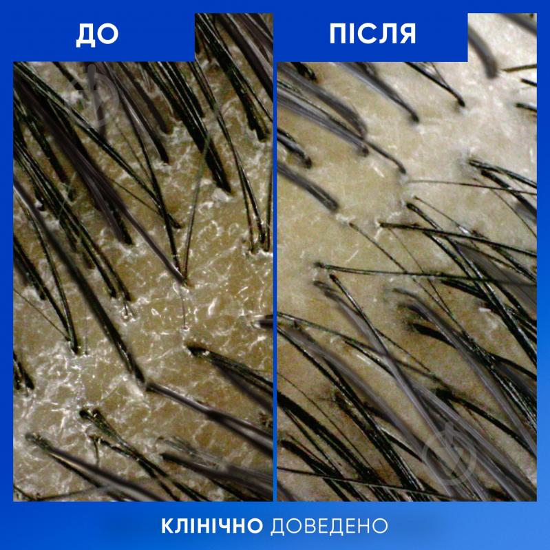 Шампунь Head & Shoulders Очищение и блеск 400 мл - фото 8 Шампунь Head & Shoulders Очищение и блеск 400 мл - фото 8