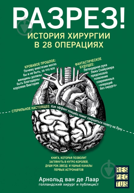 Книга Арнольд ван де Лаар «Розріз! Історія хірургії у 28 операціях» 978-617-7561-41-4 - фото 1