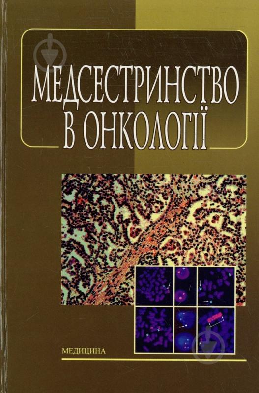 Книга Ковальчук Л.М.  «Медсестринство в онкології» 978-617-505-265-5 - фото 1