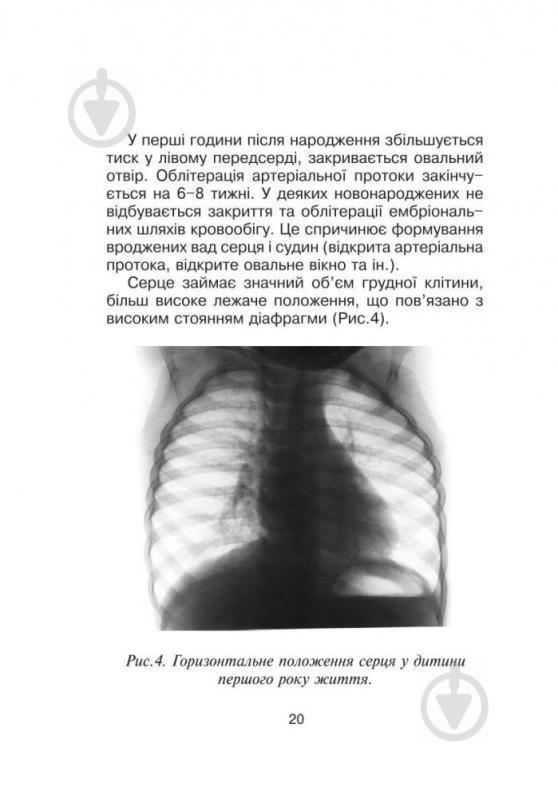 Книга Лідія Слободян «Довідник педіатра та сімейного лікаря.» 978-966-408-366-6 - фото 22