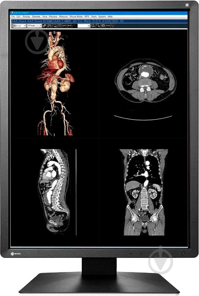 Монітор Eizo RadiForce 21" (MX216-SB) - фото 3