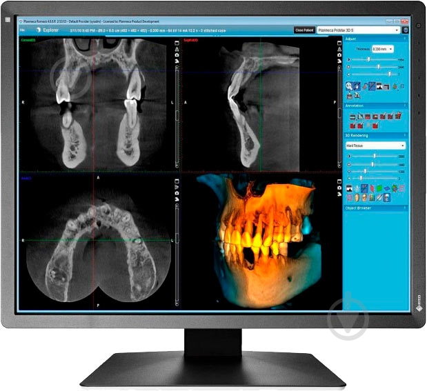 Монітор Eizo RadiForce 21" (MX216-SB) - фото 1