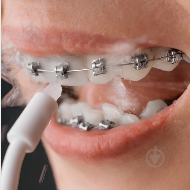 Насадки для іригатора Bitvae Bit-irr-4 - фото 2