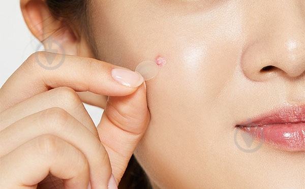 Патчи от акне COSRX Clear Fit Master 18 шт. - фото 2