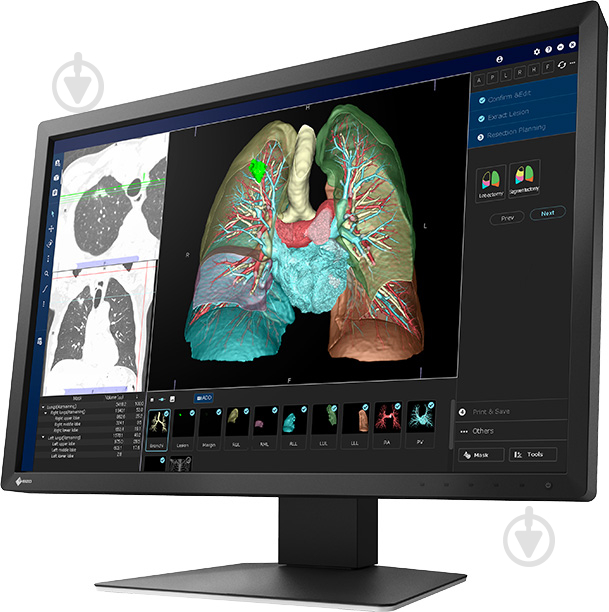 Монітор Eizo медичний RadiForce MX243W 24,1" (MX243W) - фото 2