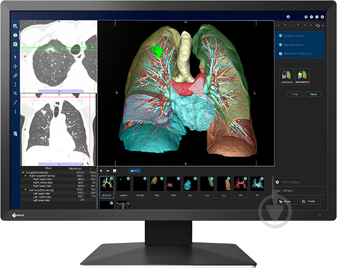 Монітор Eizo медичний RadiForce MX243W 24,1" (MX243W) - фото 1