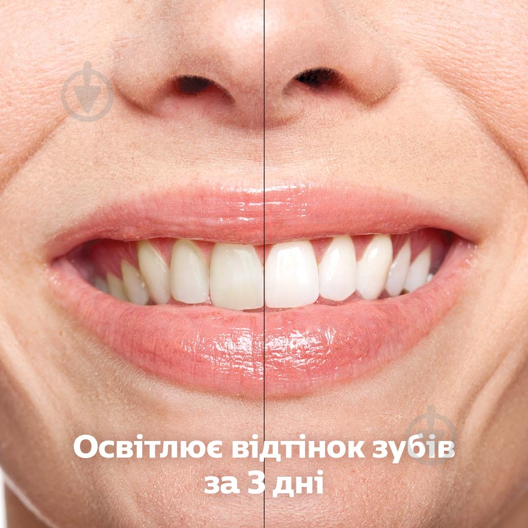 Зубна щітка Philips Sonicare Diamond Clean Smart 9400 HX9917/89 - фото 8 Зубна щітка Philips Sonicare Diamond Clean Smart 9400 HX9917/89 - фото 8