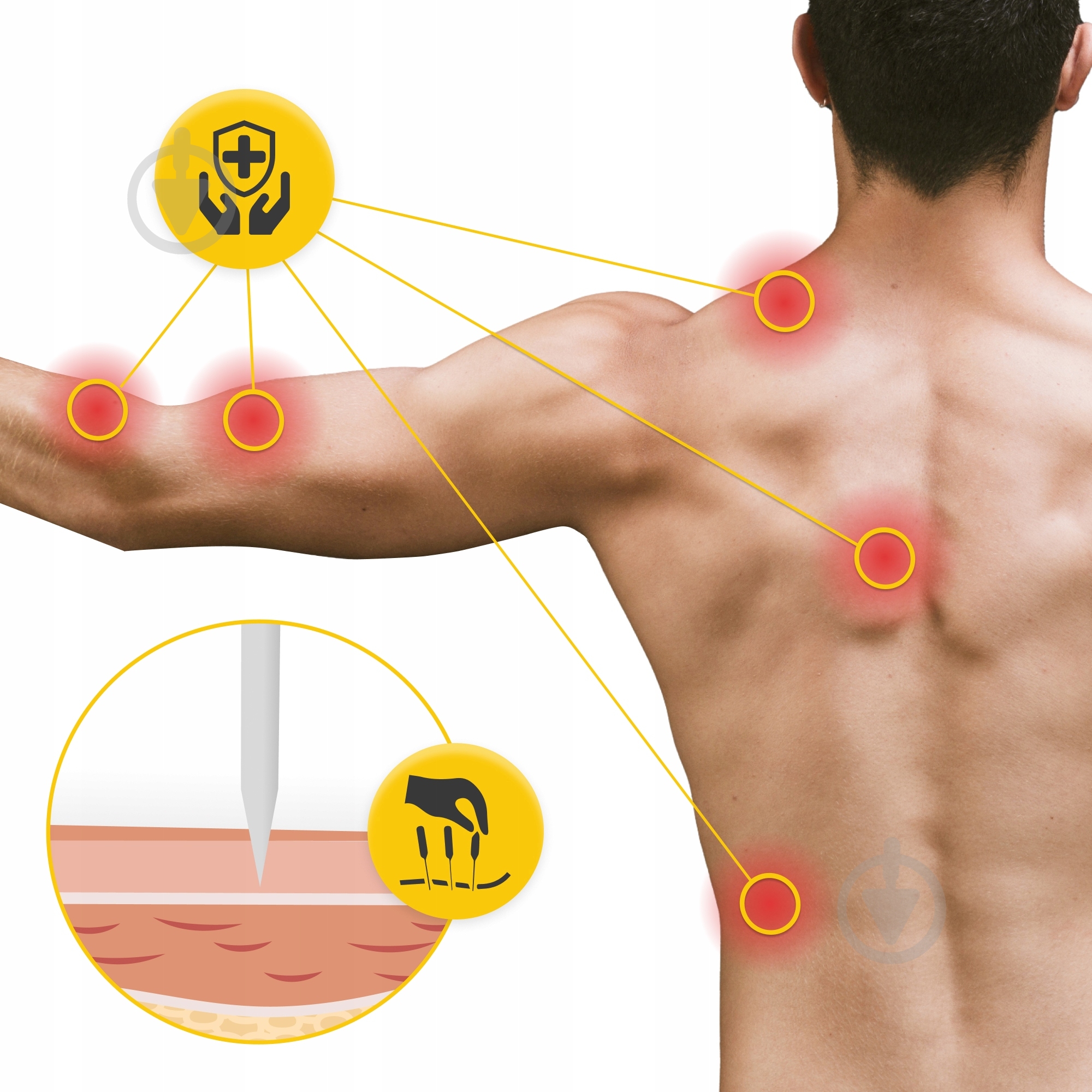 Иглы акупунктурные 4fizjo 0,3 х 40 мм с направляющей 100 шт. (P-5907739318978) - фото 7 Иглы акупунктурные 4fizjo 0,3 х 40 мм с направляющей 100 шт. (P-5907739318978) - фото 7