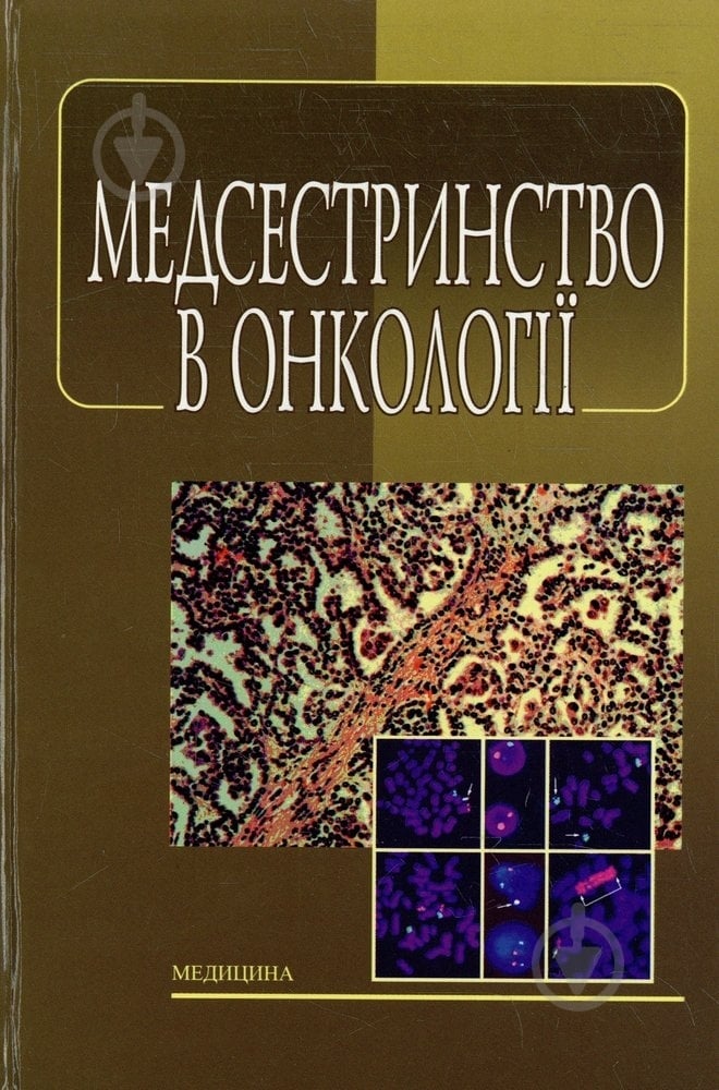 Книга Ковальчук Л.М. «Медсестринство в онкології» 978-617-505-265-5 - фото 1 Книга Ковальчук Л.М. «Медсестринство в онкології» 978-617-505-265-5 - фото 1
