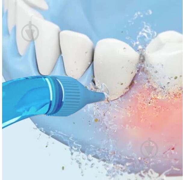 Ирригатор Soocas W3PRO Portable Oral Irrigator (880381) - фото 8