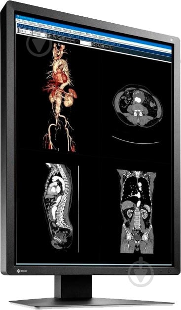 Монитор Eizo RadiForce 21" (MX216-SB) - фото 2 Монитор Eizo RadiForce 21" (MX216-SB) - фото 2