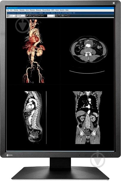 Монитор Eizo RadiForce 21" (MX216-SB) - фото 3 Монитор Eizo RadiForce 21" (MX216-SB) - фото 3