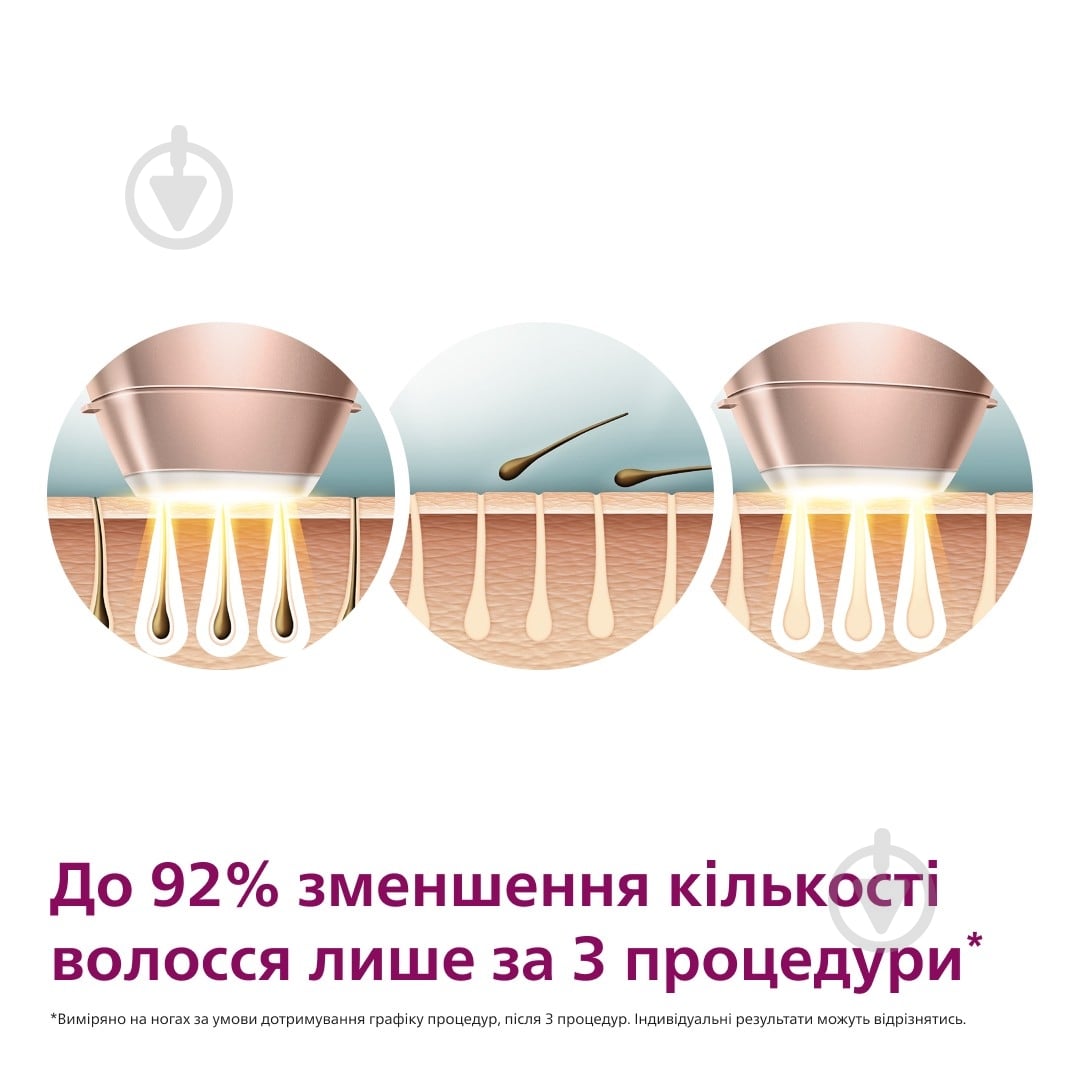 Фотоепілятор Philips Lumea Series 9900 BRI977/00 IPL з технологією SenseIQ — фото 5
