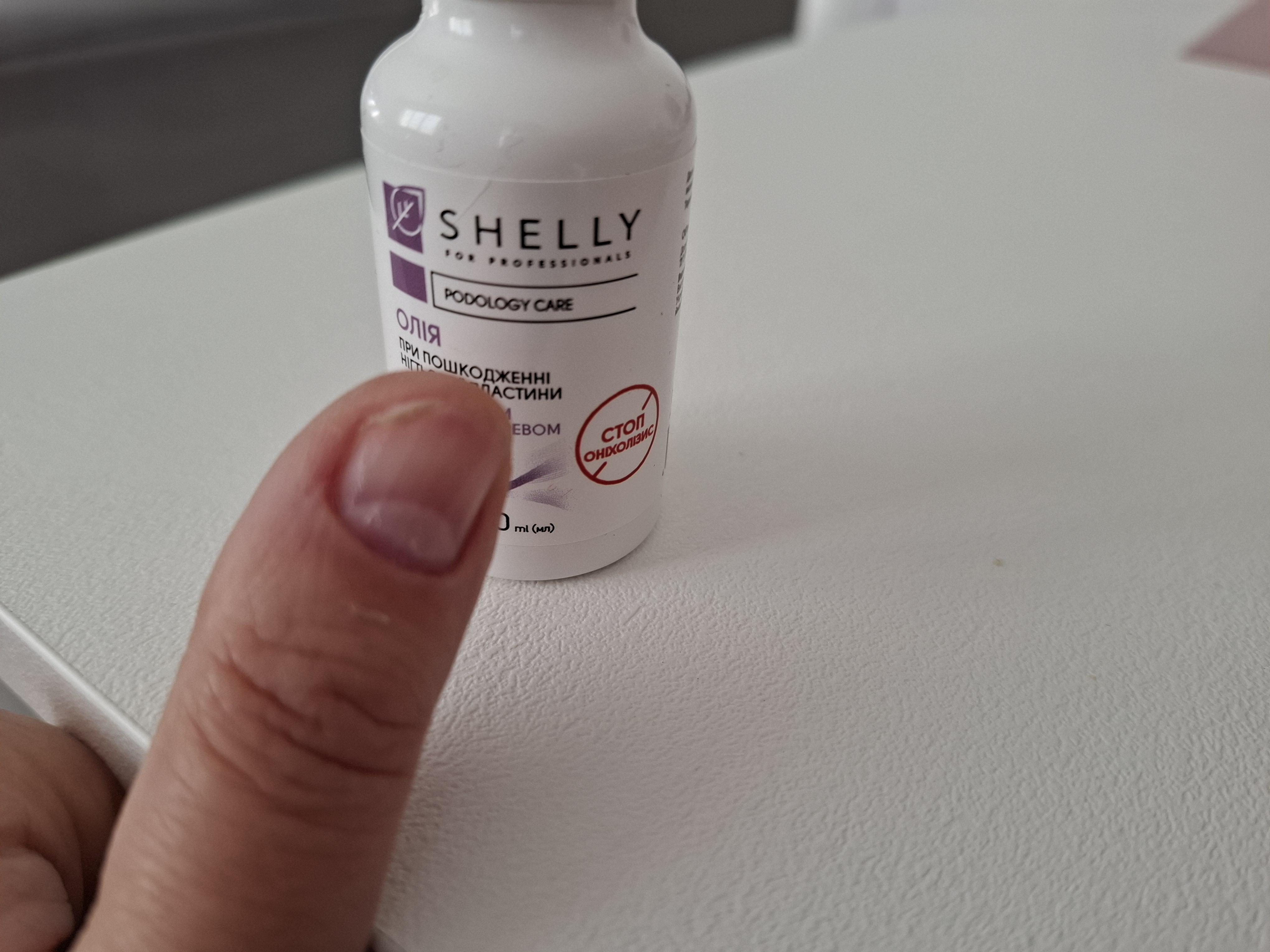 Олія SHELLY Стоп Оніхолізис Shelly 30 мл у реальних умовах використання від покупця Natasha.