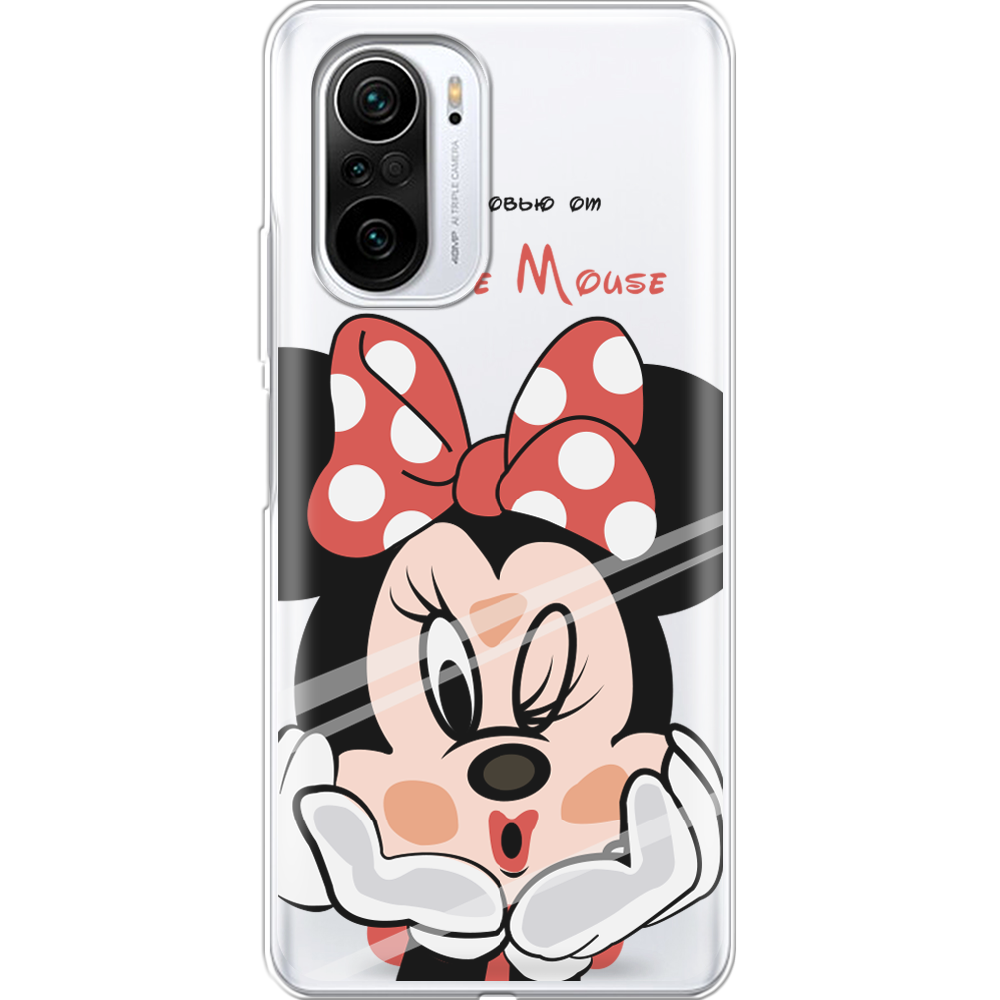 Чехол Boxface Xiaomi Mi 11i Lady M Прозрачный силикон (42102-cc59-42102)