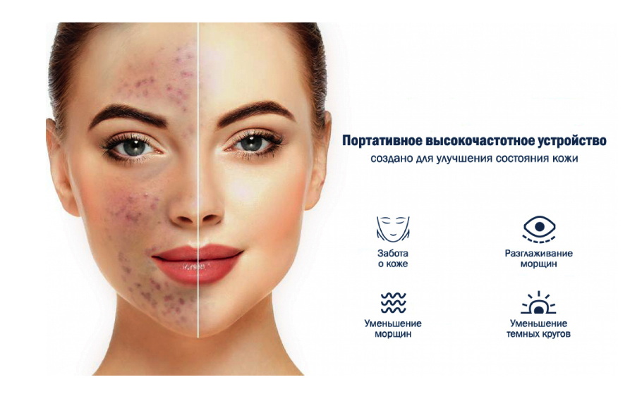 Вакуумний очищувач шкіри та пор Medica+ Skincleaner 9.0 White (10725997) - фото 3