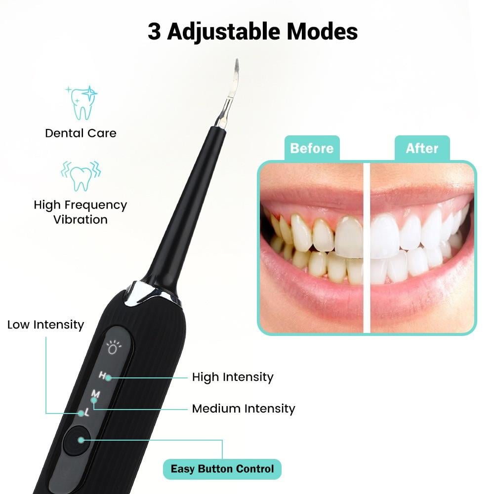 Набір Electric Dental Cleaner для видалення зубного каменю (000550) - фото 4