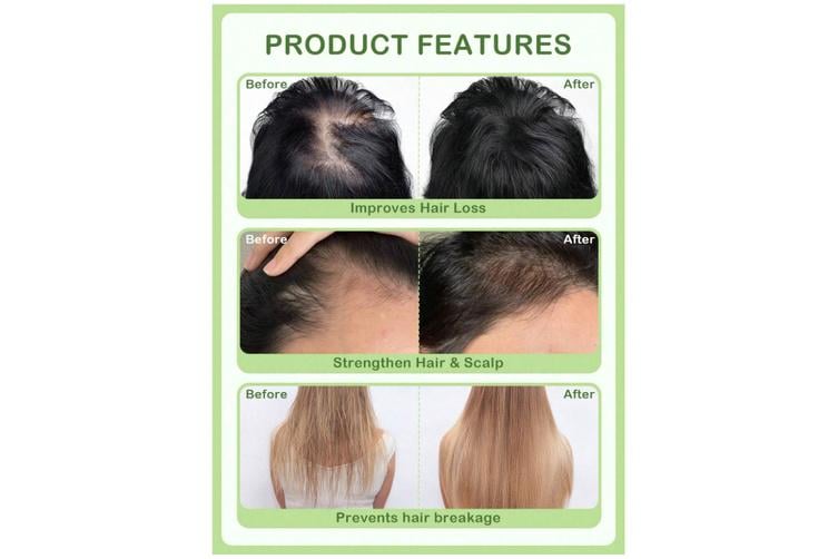 Масло эфирное для волос и кожи головы Slow Sunday Rosemary 15 мл - фото 3 Масло эфирное для волос и кожи головы Slow Sunday Rosemary 15 мл - фото 3