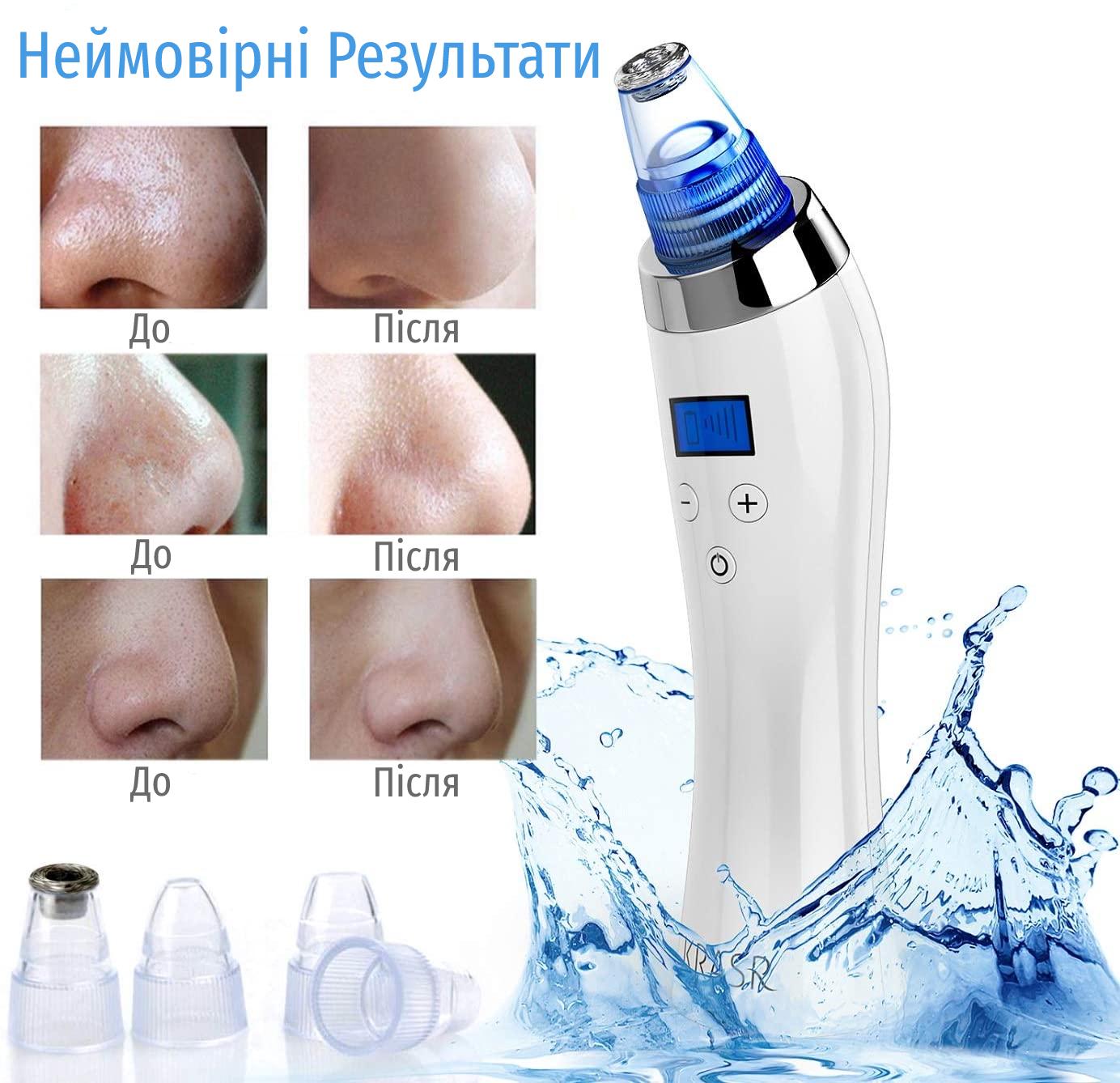 Вакуумный очиститель пор для лица KRASR Comedo Suction (1260) - фото 2