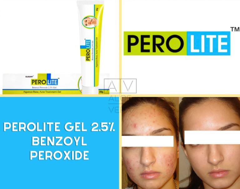 Гель против акне Perolite Gel 2.5% Benzoyl Peroxide с бензоил пероксидом 30 г (PLBP25) - фото 2