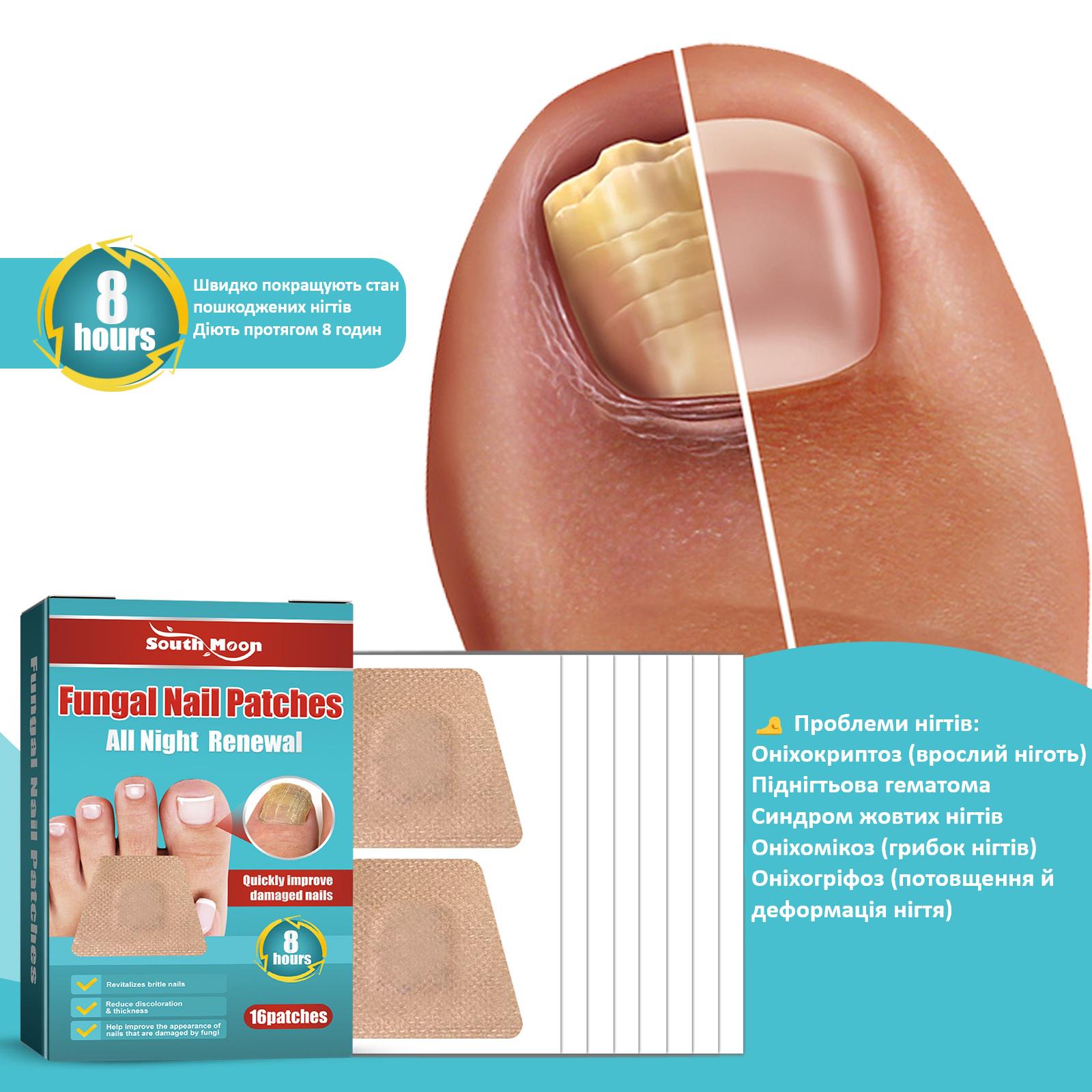 Коригувальні пластир-наклейки R9360 для врослих нігтів Nail Patches в упаковці 16 шт. - фото 7 Коригувальні пластир-наклейки R9360 для врослих нігтів Nail Patches в упаковці 16 шт. - фото 7