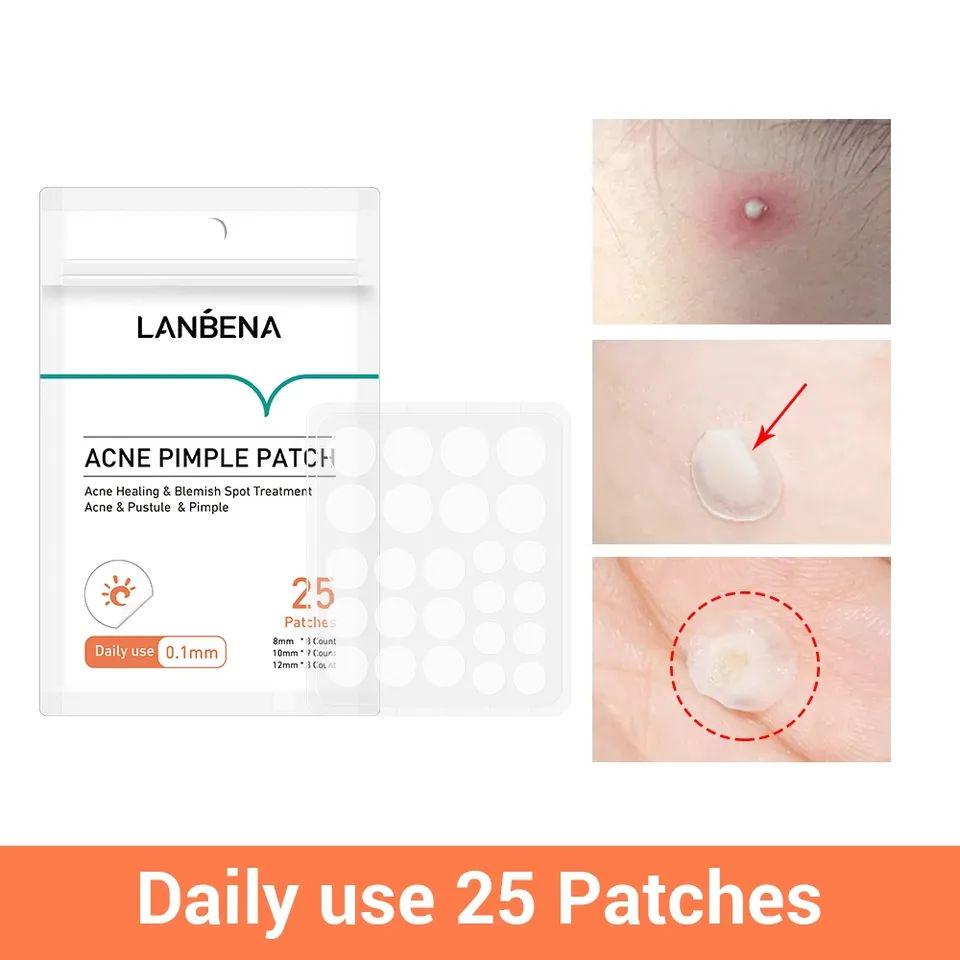 Патчи от прыщей Lanbena Acne Pimple Patch Daily Use 25 шт. (12333252) - фото 2