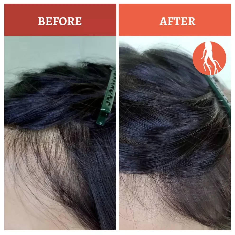 Шампунь против выпадения SH-RD Red-Ginseng Hair-Activating Shampoo профессиональный на основе красного женьшеня 200 мл (2791395645) - фото 4 Шампунь против выпадения SH-RD Red-Ginseng Hair-Activating Shampoo профессиональный на основе красного женьшеня 200 мл (2791395645) - фото 4