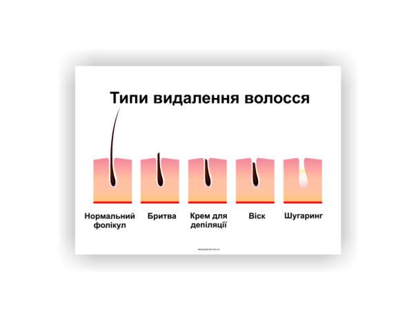 Плакат Vivay Типы удаления волос 118х84 см (25603332)