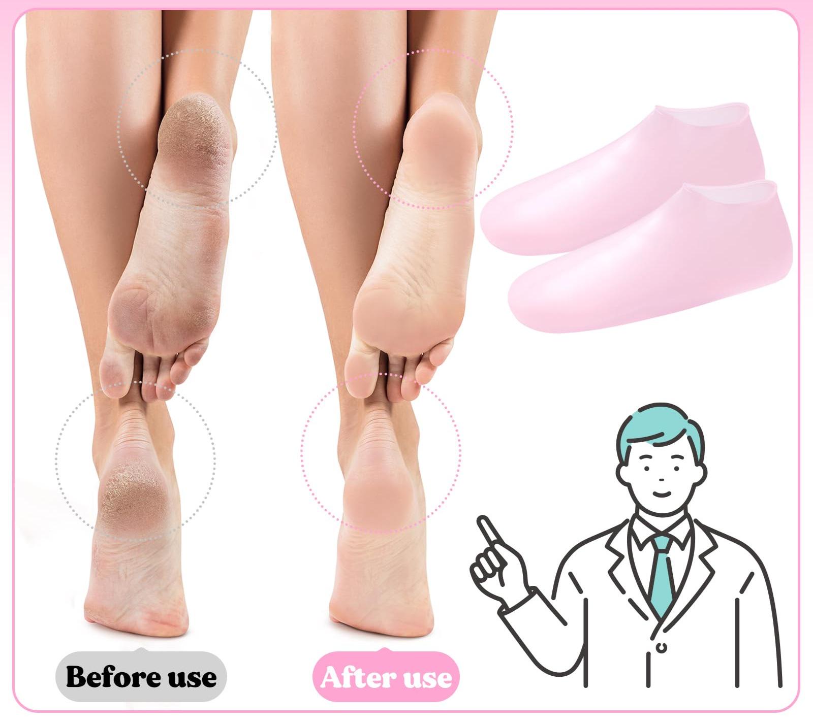 Носки силиконовые для увлажнения и ухода за кожей ног - фото 3