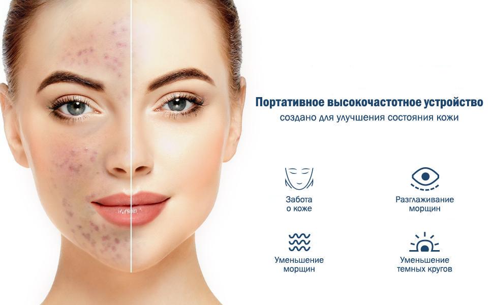 Скраббер MEDICA + Vibroscin 5.0 ультразвуковой для лица (11444040) - фото 2