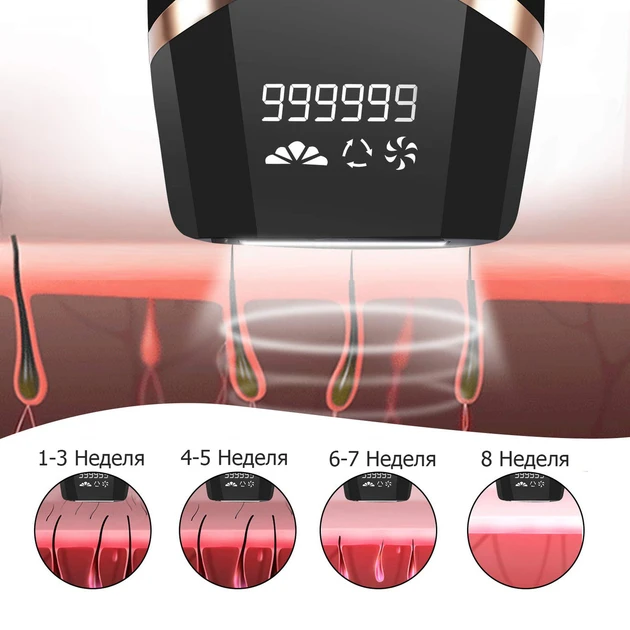 Фотоэпилятор IPL CL5 (28112658) - фото 5 Фотоэпилятор IPL CL5 (28112658) - фото 5