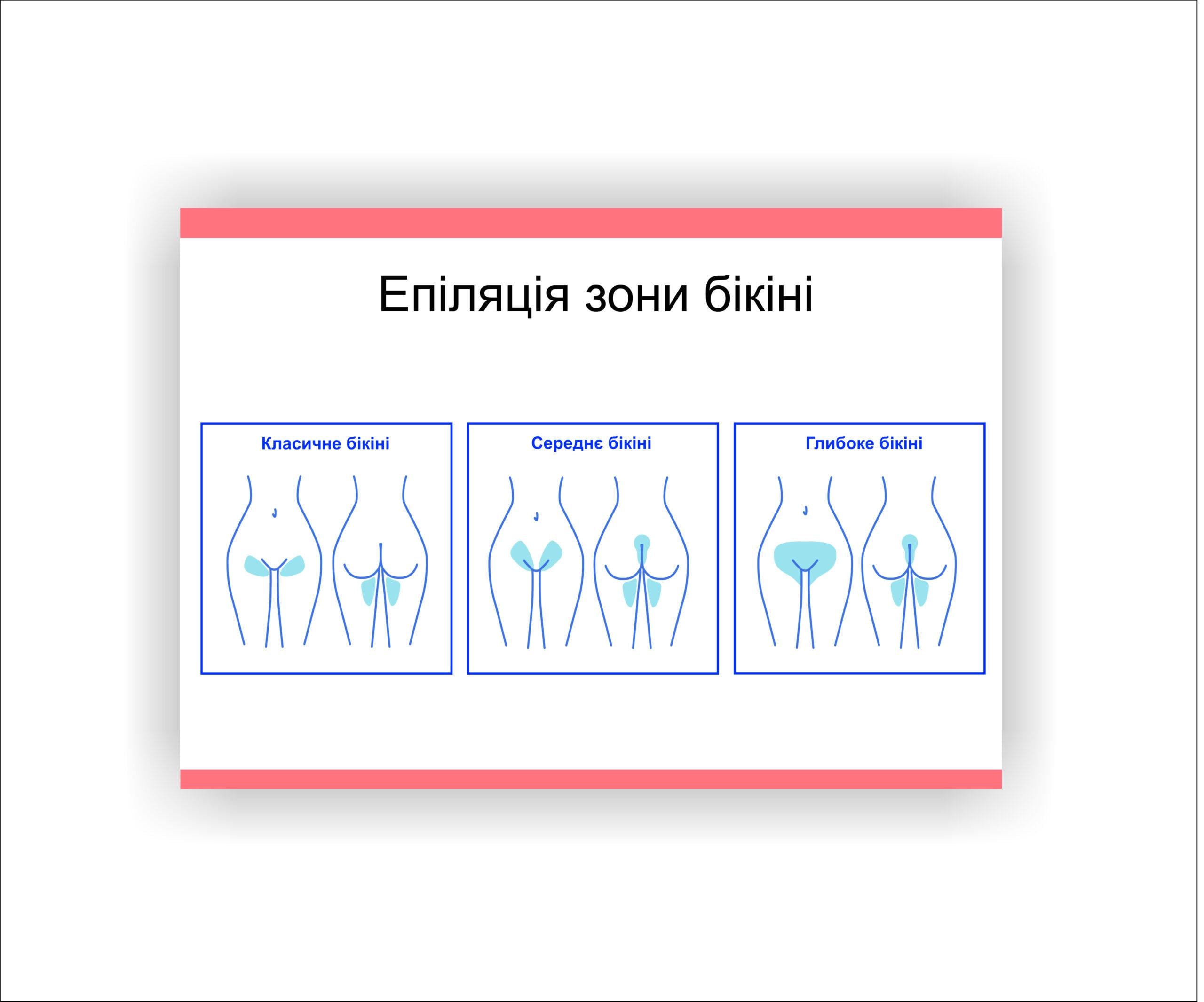 Плакат Vivay Эпиляция зоны бикини 60х80 см (25631846)