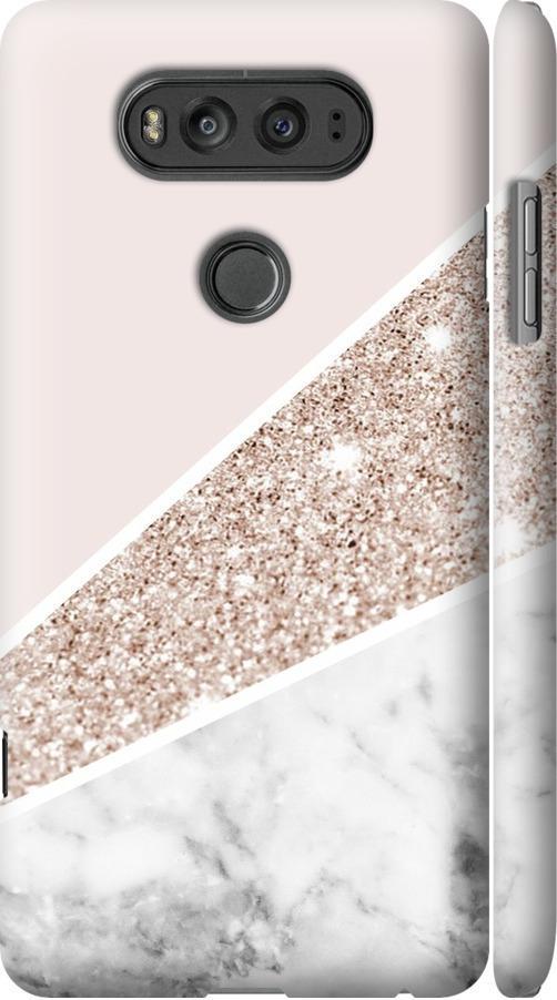 Чохол на LG V20 Пастельний мармур (4342m-787-42517)