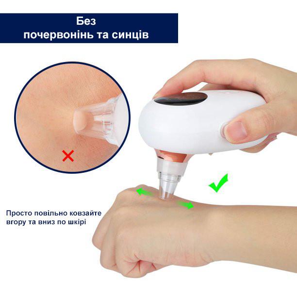 Вакуумний очищувач шкіри та пор Medica+ Skincleaner 7.0 (10711572) - фото 10