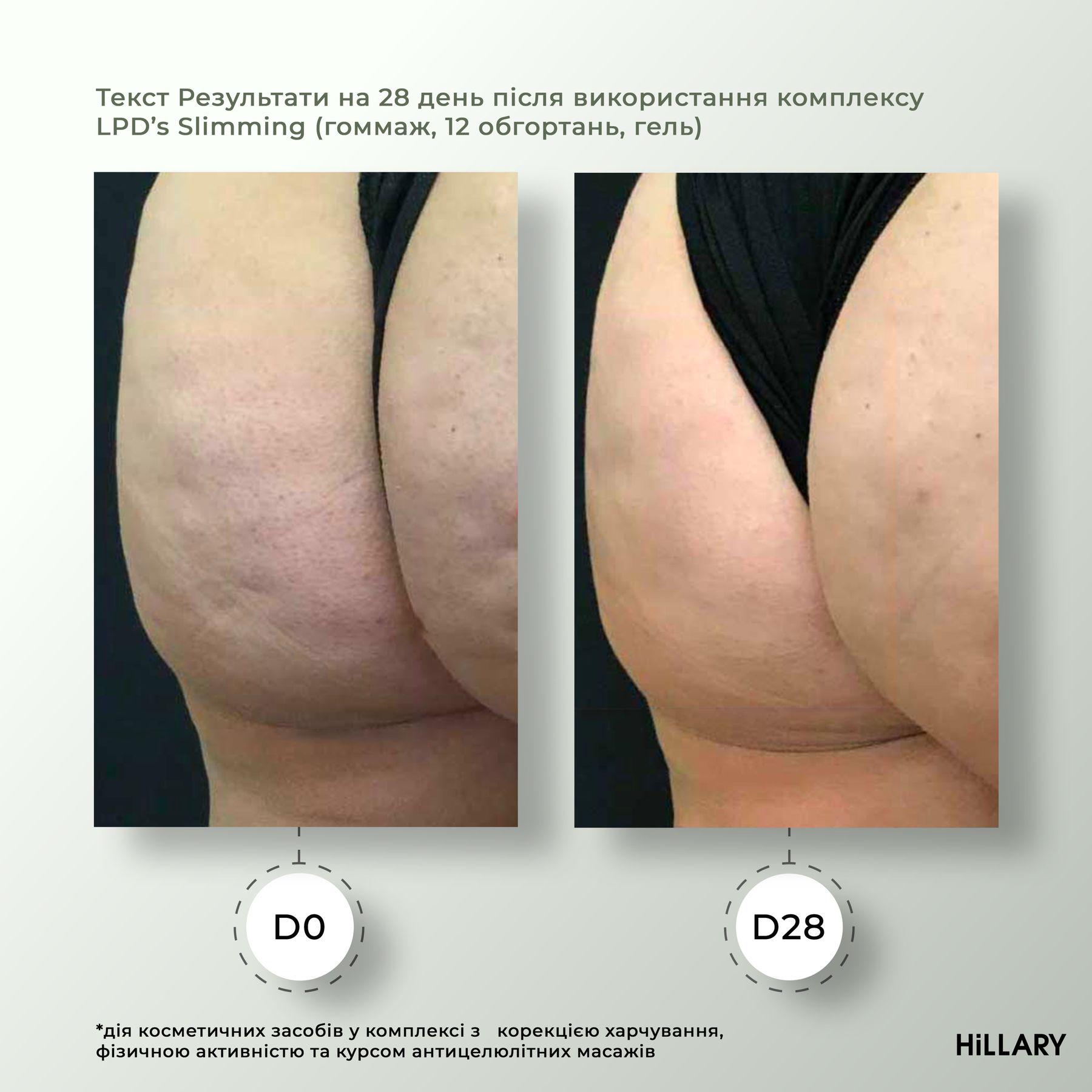 Жидкость для антицеллюлитных липосомальных обертываний Hillary Anti-cellulite Bandage LPD'S Slimming Fluid 500 мл (5597841) - фото 4