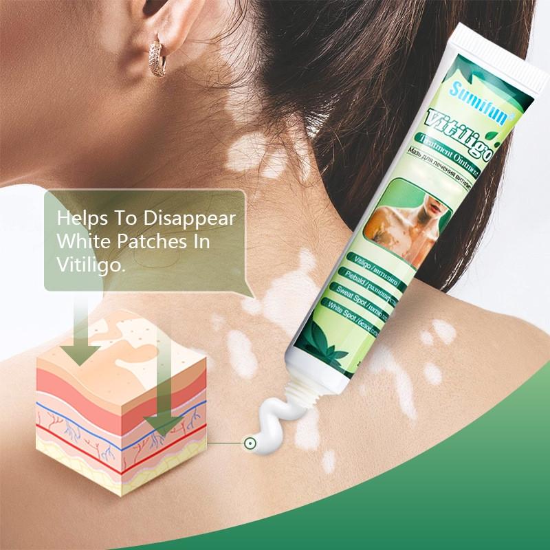 Мазь для витилиго Sumifun Vitiligo 20 г - фото 3 Мазь для витилиго Sumifun Vitiligo 20 г - фото 3