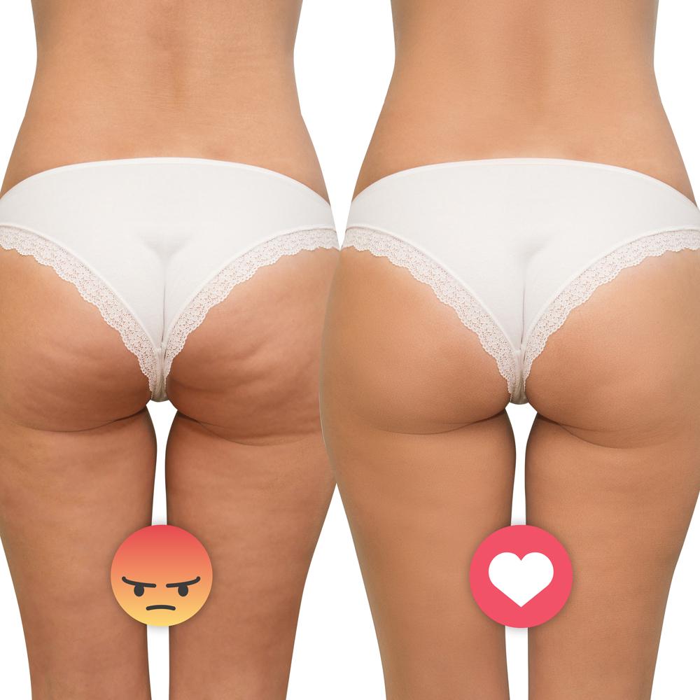 Массажер антицеллюлитный ультразвуковой inSPORTline Valeri (306234) - фото 12 Массажер антицеллюлитный ультразвуковой inSPORTline Valeri (306234) - фото 12