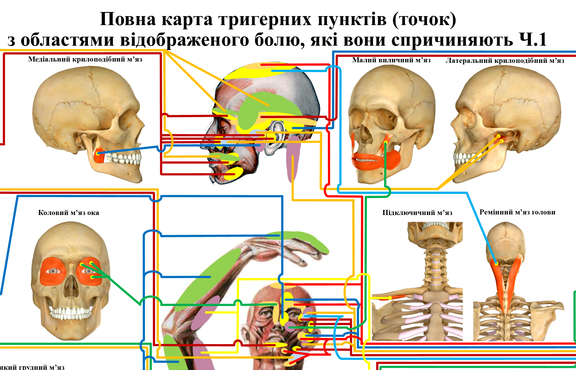 Плакат Повна карта тригерних пунктів з областями відображеного болю 119х86 см (0083) - фото 2