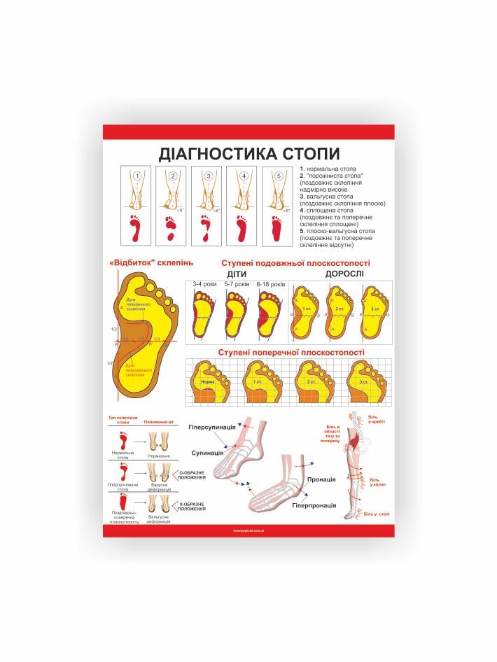 Плакат Vivay Диагностика стопы 60х40 см (25698475)