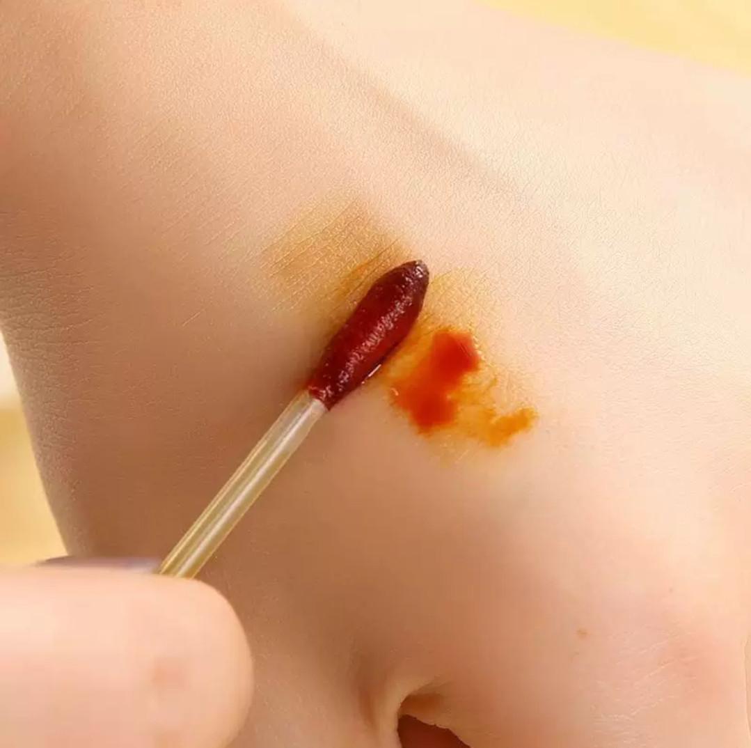 Набір одноразових антисептичний паличок з йодом 20 шт. (2734326915) - фото 4 Набір одноразових антисептичний паличок з йодом 20 шт. (2734326915) - фото 4