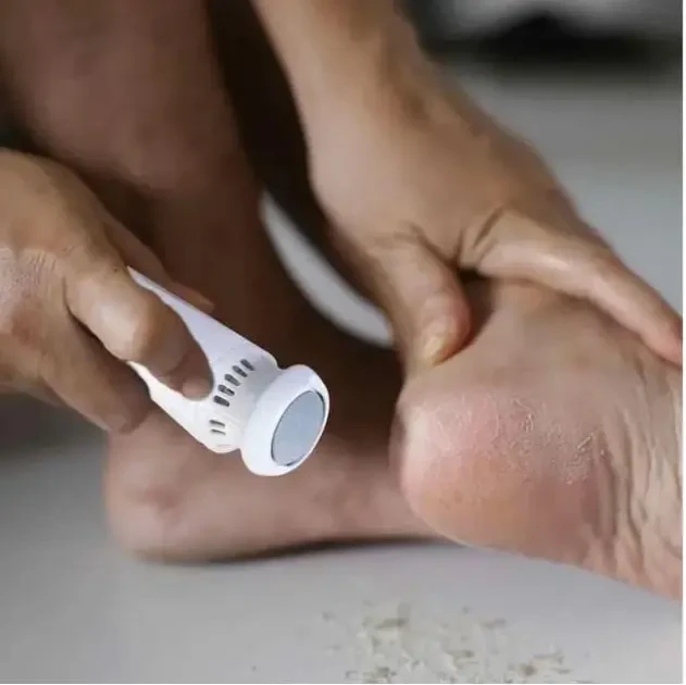 Пемза электрическая FOOT GRINDER 928-3 для ног и пяток с насадками - фото 2 Пемза электрическая FOOT GRINDER 928-3 для ног и пяток с насадками - фото 2