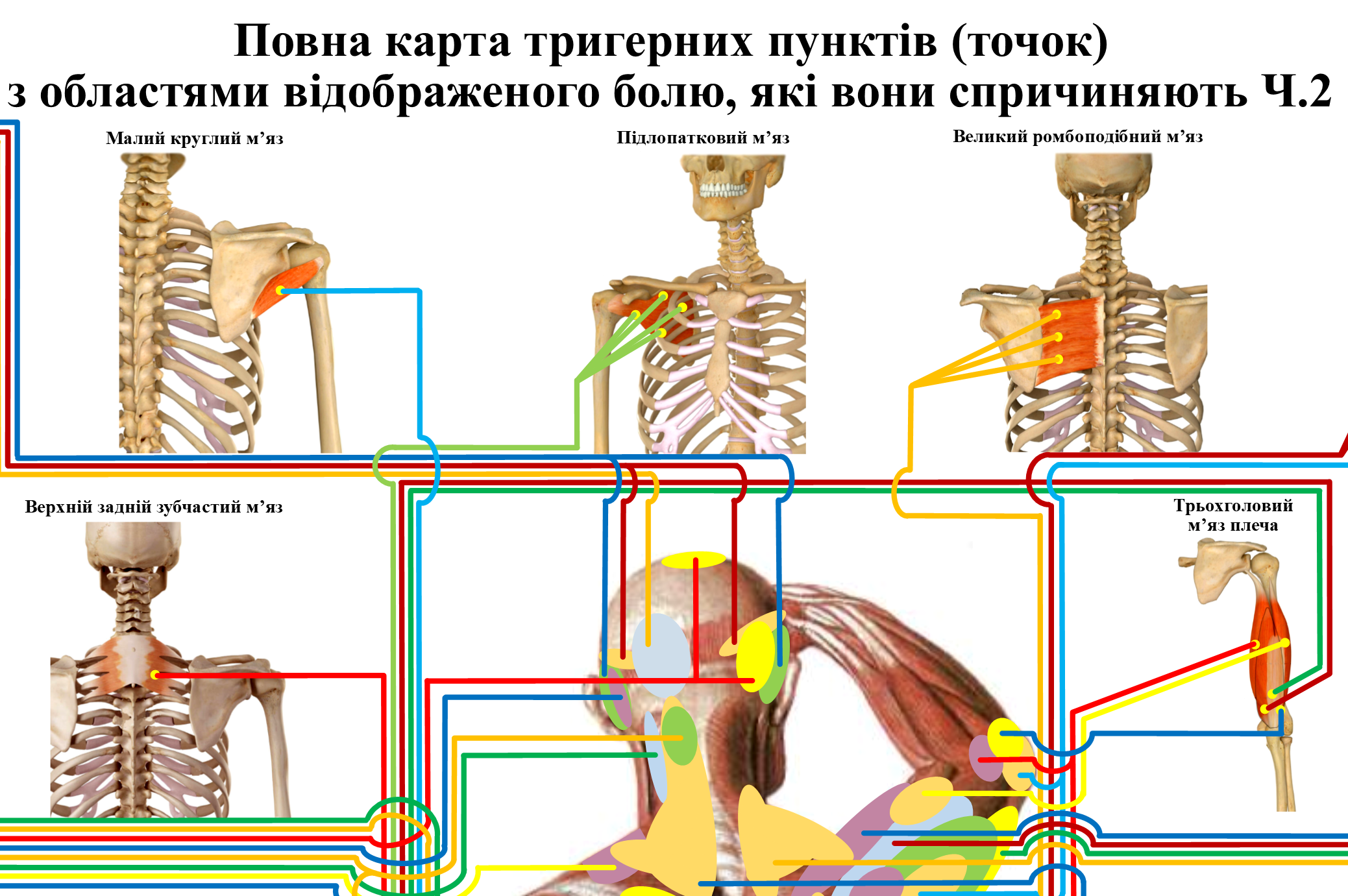 Плакат Повна карта тригерних пунктів з областями відображеного болю 119х86 см (0083) - фото 3