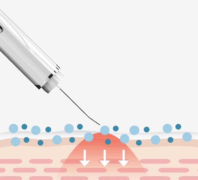 Скрабер SUNROZ C-107 Ultrasonic Ion Cleansin г Instrument ультразвуковой очиститель пор с дисплеем Белый - фото 2