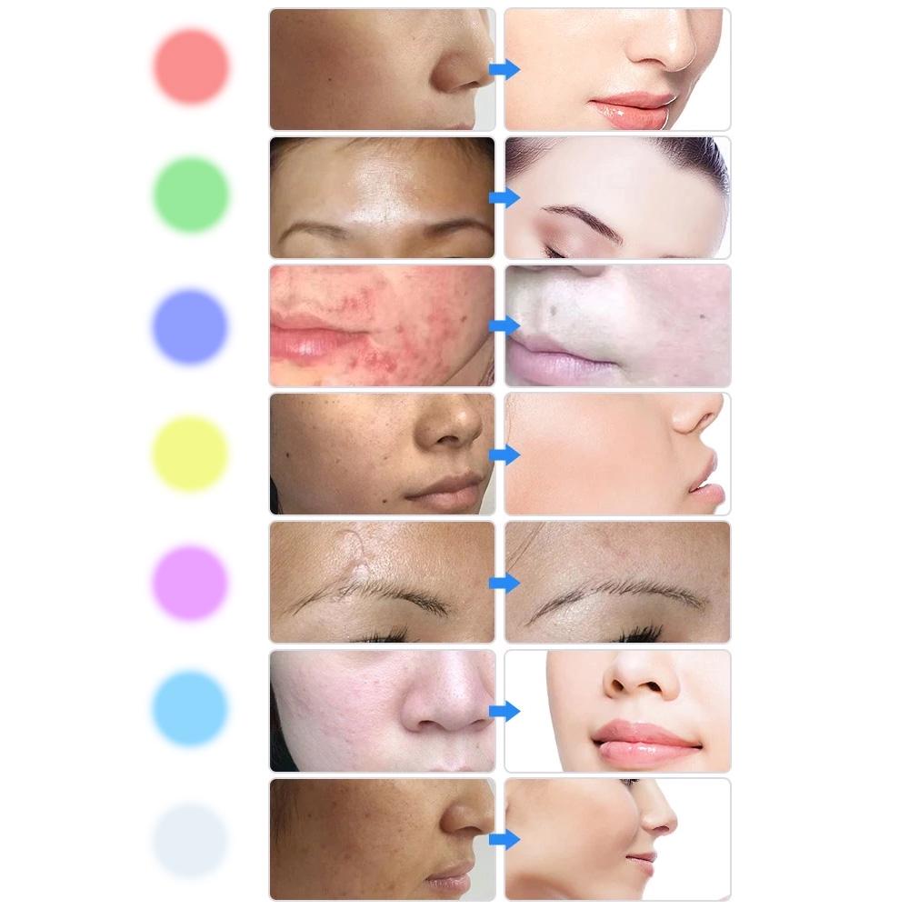 Маска світлодіодна для обличчя inSPORTline Esgrima - фото 4 Маска світлодіодна для обличчя inSPORTline Esgrima - фото 4